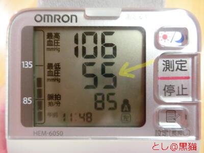 拡張期血圧（最低血圧）が低いのが気になる