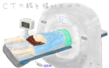 腎細胞がん 追跡検査 造影剤 CT 検査