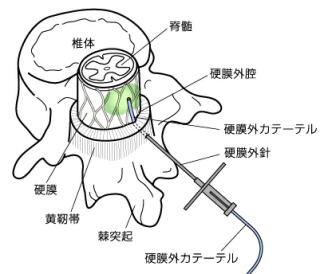 腎部分切除手術の日でした