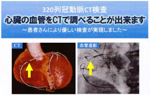 3D_MDCT_HRT.jpg