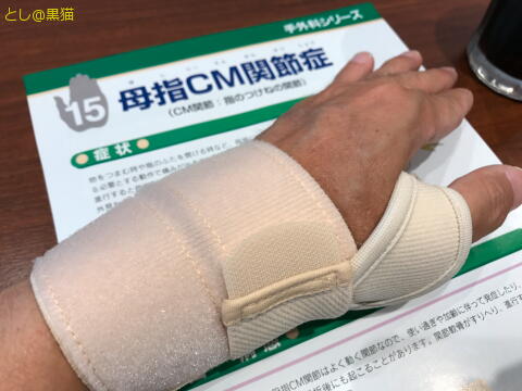 軽度の母指CM関節症もどき で保存治療