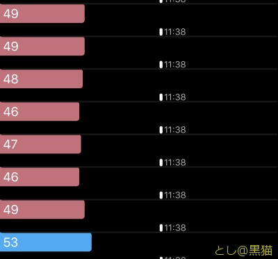 徐脈性不整脈で病院へ GO