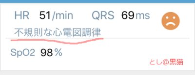 徐脈性不整脈で病院へ GO