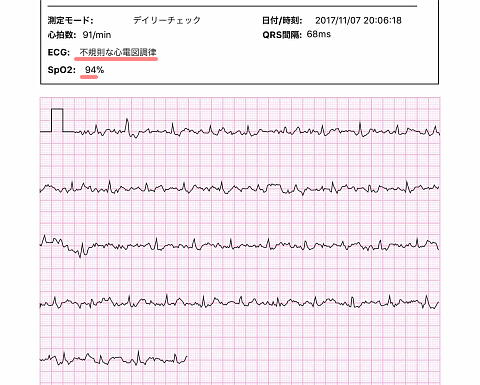 全て異常な心電図