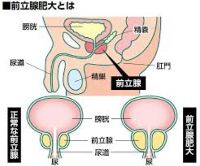 zenritsusen-01.jpg